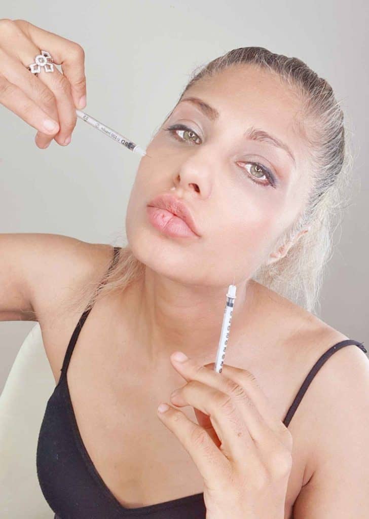 A PICTURE OF DR NIRDOSH HERSELF INJECTING FILLER INTO HER OWN JAWLINE - Dr Nirdosh Clinic